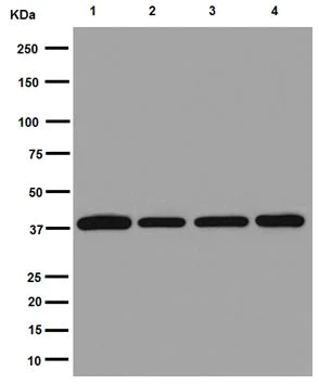 Western blot - Anti-ACAT2/Acetyl-CoA acetyltransferase antibody [EPR8416(2)] - BSA and Azide free (AB251082)