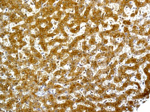 Immunohistochemistry (Formalin/PFA-fixed paraffin-embedded sections) - Anti-ACAT2/Acetyl-CoA acetyltransferase antibody [EPR8417] (AB131215), expandable thumbnail