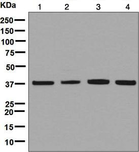 Western blot - Anti-ACAT2/Acetyl-CoA acetyltransferase antibody [EPR8417] (AB131215), expandable thumbnail