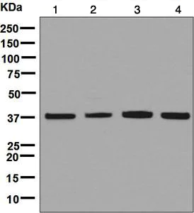 Western blot - Anti-ACAT2/Acetyl-CoA acetyltransferase antibody [EPR8417] - BSA and Azide free (AB248375)