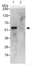 Immunoprecipitation - Anti-ACD antibody (AB112050)