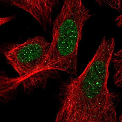 Immunocytochemistry/ Immunofluorescence - Anti-ACD antibody (AB220740)