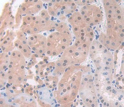 Immunohistochemistry (Formalin/PFA-fixed paraffin-embedded sections) - Anti-ACD antibody (AB231330)