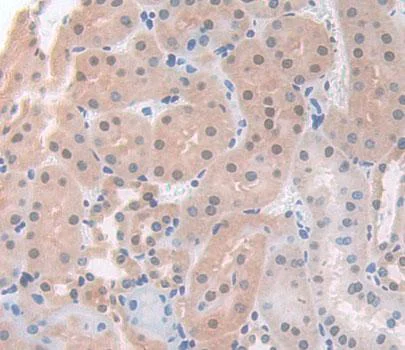 Immunohistochemistry (Formalin/PFA-fixed paraffin-embedded sections) - Anti-ACD antibody (AB231330)