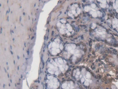 Immunohistochemistry (Formalin/PFA-fixed paraffin-embedded sections) - Anti-ACD antibody (AB231330)