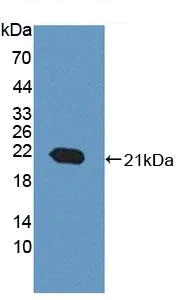 Western blot - Anti-ACD antibody (AB231330)