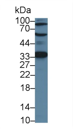 Western blot - Anti-ACD antibody (AB231330)