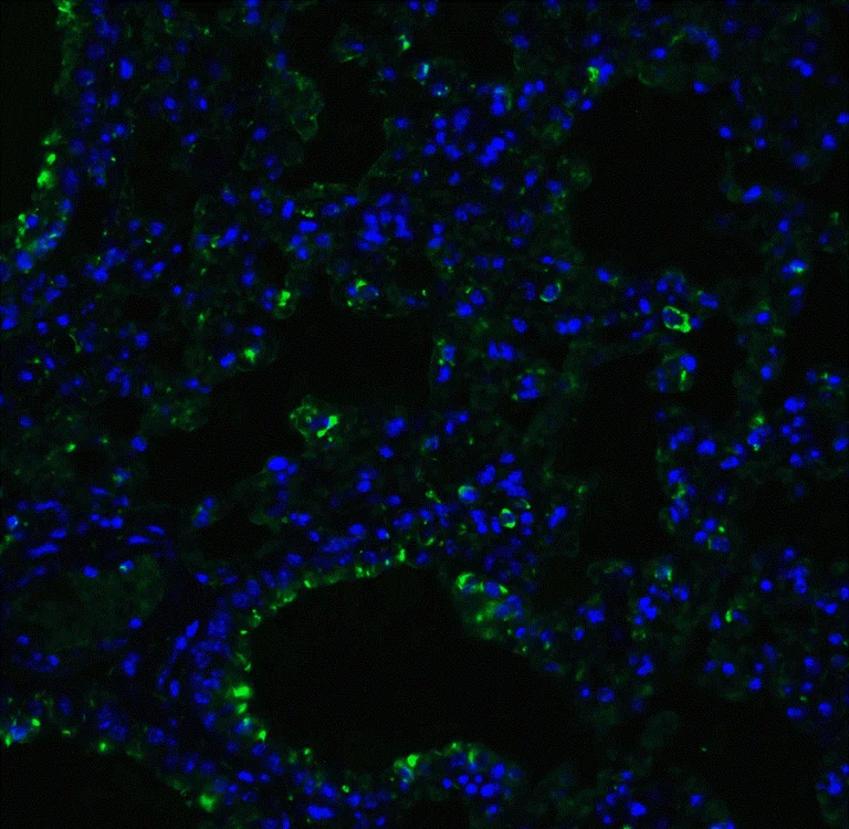 Immunohistochemistry (Formalin/PFA-fixed paraffin-embedded sections) - Anti-ACE2 antibody (AB15348)