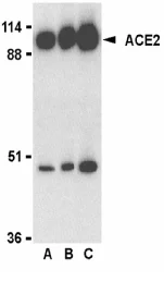 Western blot - Anti-ACE2 antibody (AB15348)