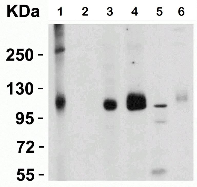 Western blot - Anti-ACE2 antibody (AB15348)