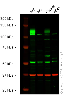 Western blot - Anti-ACE2 antibody (AB15348)