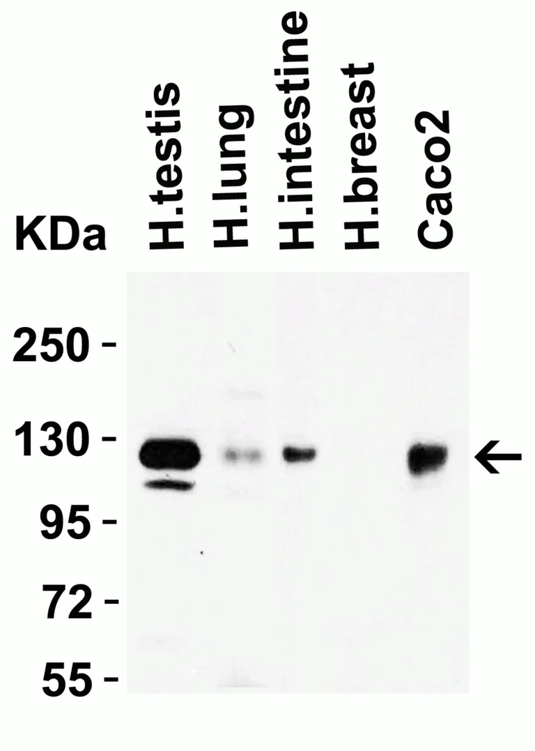 Western blot - Anti-ACE2 antibody (AB15348)