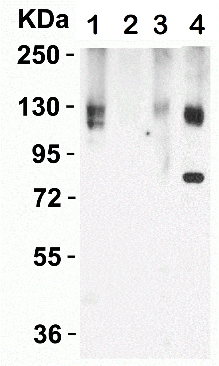 Western blot - Anti-ACE2 antibody (AB15348)