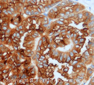 Immunohistochemistry (Formalin/PFA-fixed paraffin-embedded sections) - Anti-ACE2 antibody (AB65863)