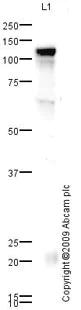 Western blot - Anti-ACE2 antibody (AB65863)