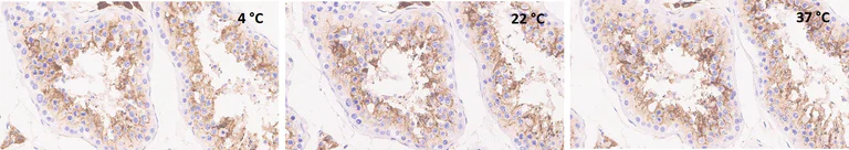 Immunohistochemistry (Formalin/PFA-fixed paraffin-embedded sections) - Anti-ACE2 antibody [EPR24705-45] (AB272500)