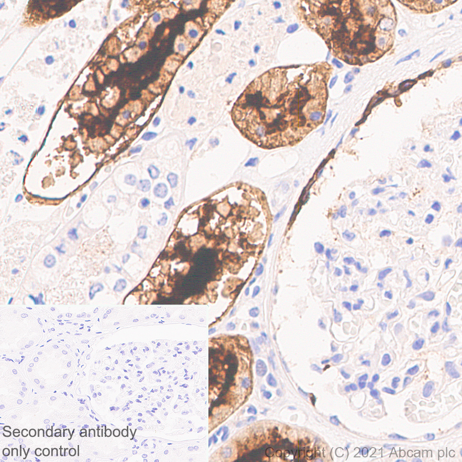 Immunohistochemistry (Formalin/PFA-fixed paraffin-embedded sections) - Anti-ACE2 antibody [EPR24705-45] - BSA and Azide free (ab282118), expandable thumbnail