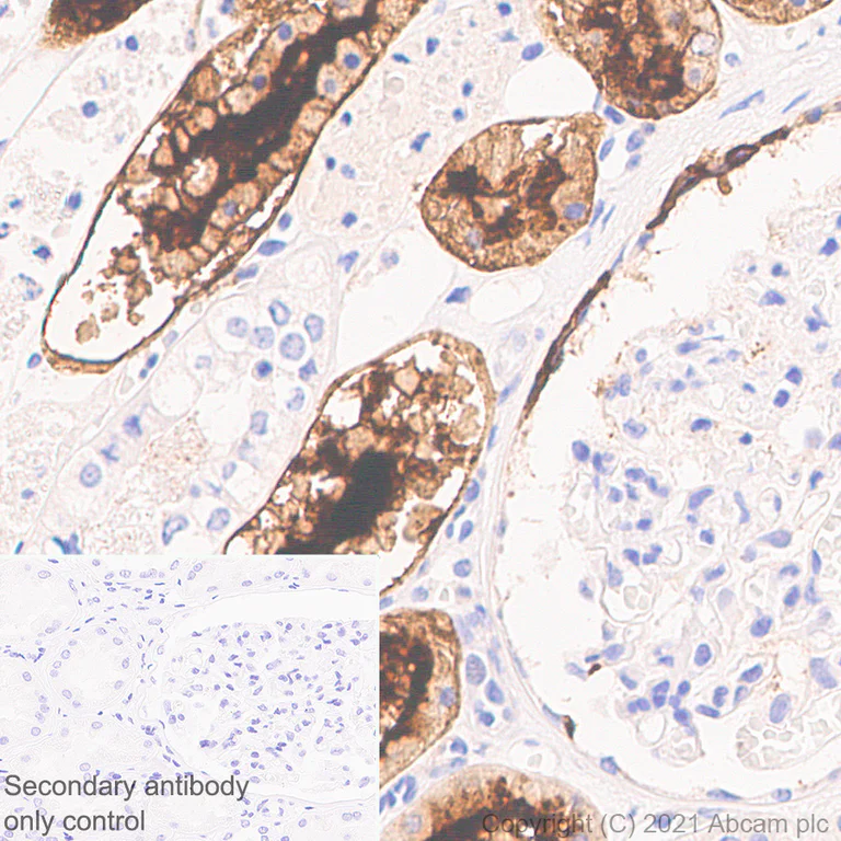 Immunohistochemistry (Formalin/PFA-fixed paraffin-embedded sections) - Anti-ACE2 antibody [EPR24705-45] - BSA and Azide free (AB282118)