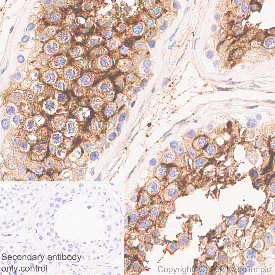 Immunohistochemistry (Formalin/PFA-fixed paraffin-embedded sections) - Anti-ACE2 antibody [EPR24705-45] - BSA and Azide free (AB282118), expandable thumbnail