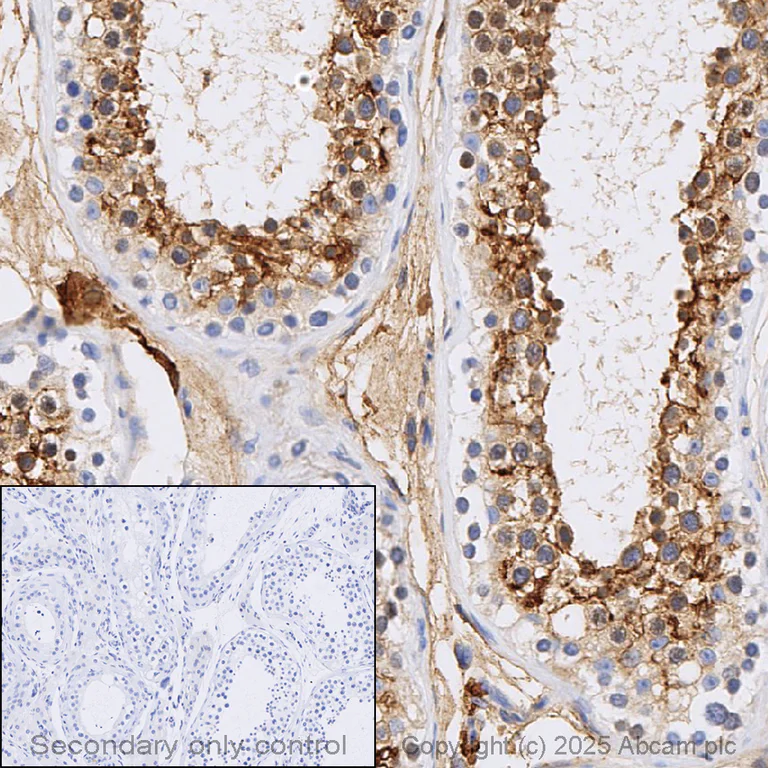 Immunohistochemistry (Formalin/PFA-fixed paraffin-embedded sections) - Anti-ACE2 antibody [EPR4435(2)] (AB108252)