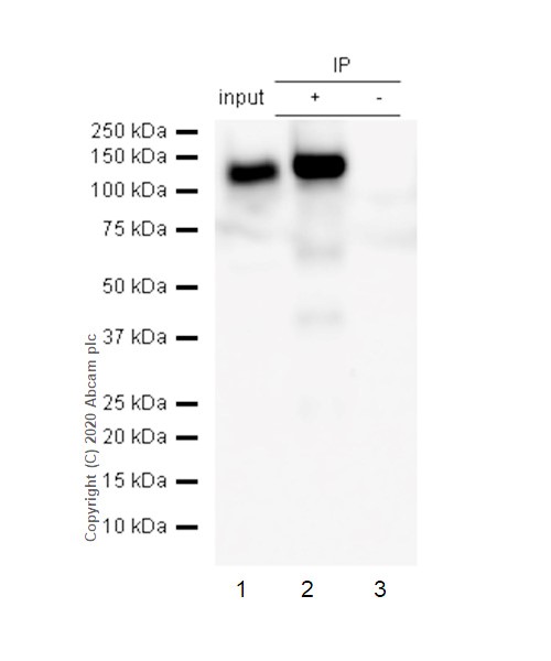Immunoprecipitation - Anti-ACE2 antibody [EPR4435(2)] (AB108252), expandable thumbnail