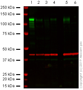 Western blot - Anti-ACE2 antibody [EPR4435(2)] (AB108252), expandable thumbnail