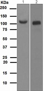 Western blot - Anti-ACE2 antibody [EPR4435(2)] (ab108252), expandable thumbnail