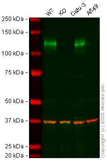 Western blot - Anti-ACE2 antibody [EPR4435(2)] (AB108252), expandable thumbnail