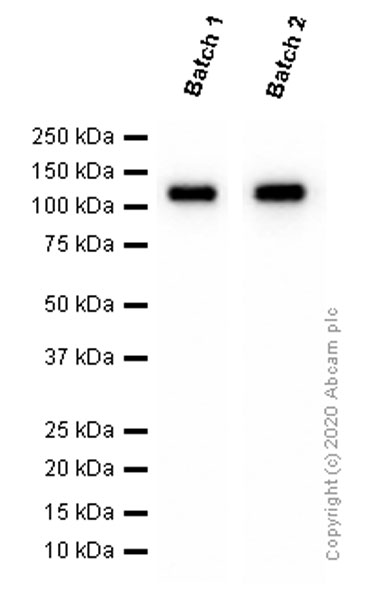 Western blot - Anti-ACE2 antibody [EPR4435(2)] (ab108252), expandable thumbnail