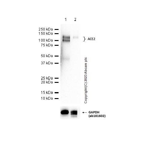 Western blot - Anti-ACE2 antibody [EPR4435(2)] (ab108252), expandable thumbnail