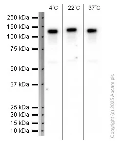 Western blot - Anti-ACE2 antibody [EPR4435(2)] (AB108252)