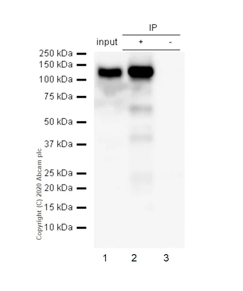 Immunoprecipitation - Anti-ACE2 antibody [EPR4435(2)] - BSA and Azide free (AB239924)