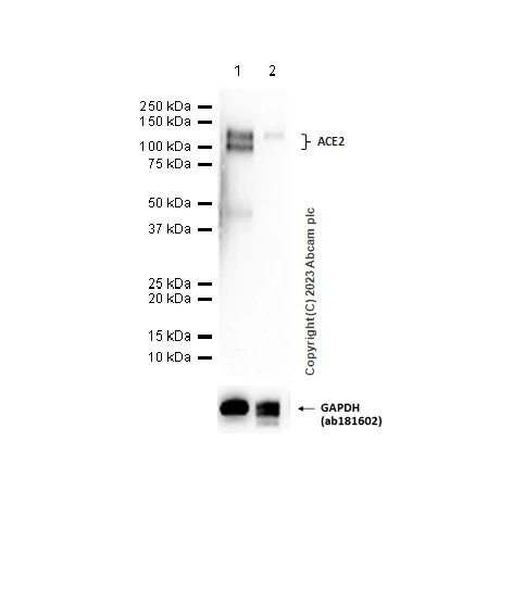 Western blot - Anti-ACE2 antibody [EPR4435(2)] - BSA and Azide free (AB239924)