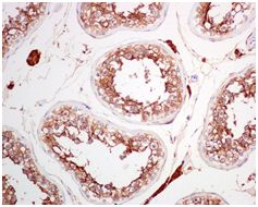 Immunohistochemistry (Formalin/PFA-fixed paraffin-embedded sections) - Anti-ACE2 antibody [EPR4436] (ab108209), expandable thumbnail