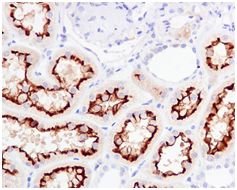 Immunohistochemistry (Formalin/PFA-fixed paraffin-embedded sections) - Anti-ACE2 antibody [EPR4436] (AB108209), expandable thumbnail