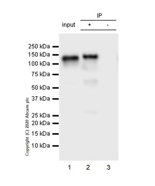 Immunoprecipitation - Anti-ACE2 antibody [EPR4436] (AB108209), expandable thumbnail