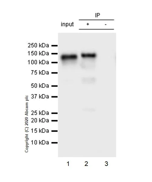 Immunoprecipitation - Anti-ACE2 antibody [EPR4436] (AB108209)