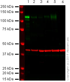 Western blot - Anti-ACE2 antibody [EPR4436] (AB108209)