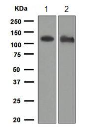 Western blot - Anti-ACE2 antibody [EPR4436] (ab108209), expandable thumbnail