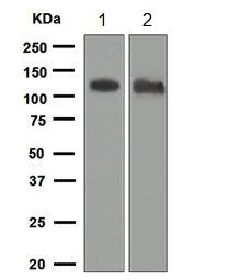Western blot - Anti-ACE2 antibody [EPR4436] (AB108209)