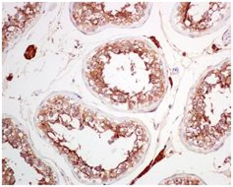 Immunohistochemistry (Formalin/PFA-fixed paraffin-embedded sections) - Anti-ACE2 antibody [EPR4436] - BSA and Azide free (AB247610)