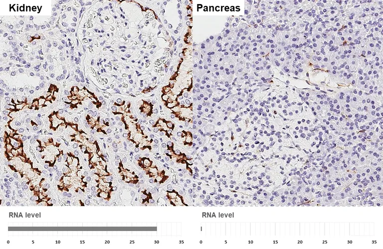 Immunohistochemistry (Formalin/PFA-fixed paraffin-embedded sections) - Anti-ACE2 antibody [HL1092] (AB308378)