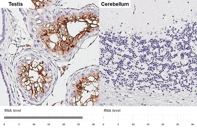 Immunohistochemistry (Formalin/PFA-fixed paraffin-embedded sections) - Anti-ACE2 antibody [HL1092] (AB308378)