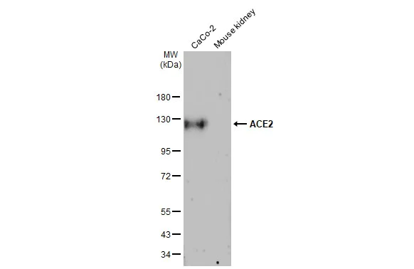 Western blot - Anti-ACE2 antibody [HL1092] (AB308378)