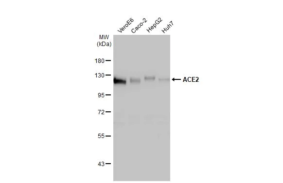 Western blot - Anti-ACE2 antibody [HL1092] (AB308378)