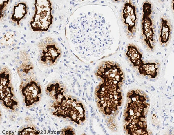 Immunohistochemistry (Formalin/PFA-fixed paraffin-embedded sections) - Anti-ACE2 antibody [MM0073-11A31] (AB89111)