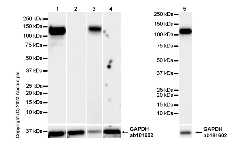 Western blot - Anti-ACE2 antibody [RM1070] (AB314771)