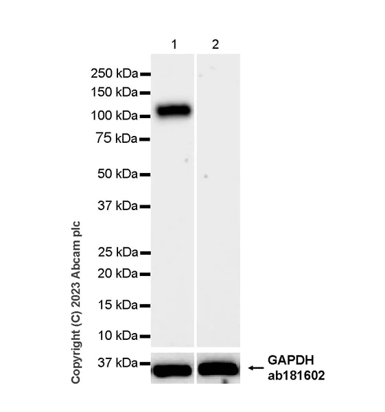 Western blot - Anti-ACE2 antibody [RM1070] (AB314771)