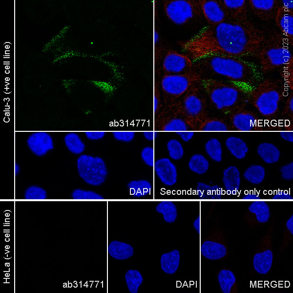 Immunocytochemistry/ Immunofluorescence - Anti-ACE2 antibody [RM1070] - BSA and Azide free (ab314772), expandable thumbnail