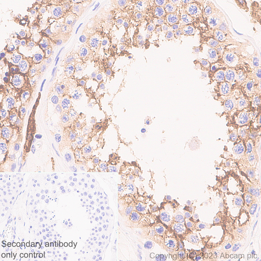 Immunohistochemistry (Formalin/PFA-fixed paraffin-embedded sections) - Anti-ACE2 antibody [RM1070] - BSA and Azide free (ab314772), expandable thumbnail